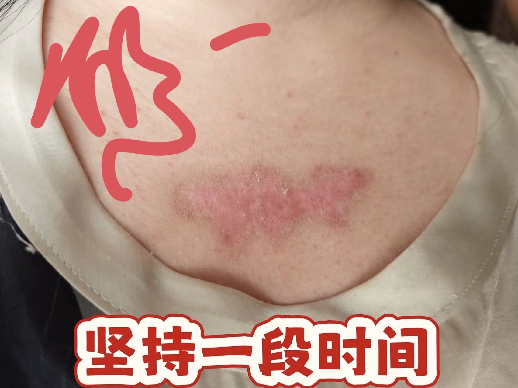 供需图片