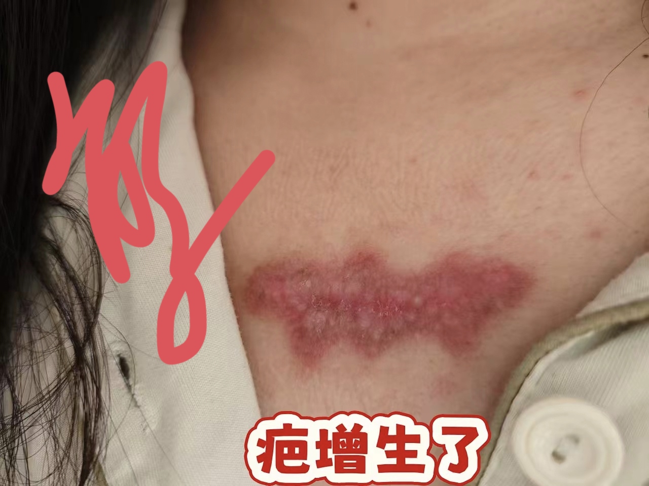 供需图片